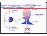 Streptococcus Carrier Images