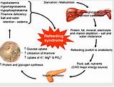 Pictures of Short Bowel Syndrome Treatment Guidelines