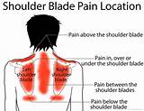 Photos of Can Gas Cause Shoulder Blade Pain