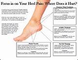 Foot Pain In Heel And Side Of Foot Images