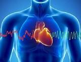 Photos of How Do Doctors Treat Heart Attacks