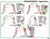 Trigger Point Therapy Shoulder Images