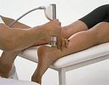 Shockwave Therapy Achilles