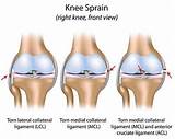 Knee Physicians Images