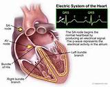 Images of Electrical Wiring Of The Heart