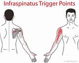 Infraspinatus Muscle Exercises