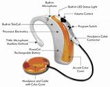 Images of Advanced Bionics Cochlear Implant Mri