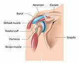 Bursitis Medical Definition Images