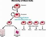 Stem Cell Therapy For Kidney Failure Images