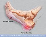 What Doctor To See For Foot Pain Pictures
