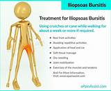 Images of Iliopsoas Muscle Strengthening Exercises