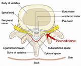 Images of Chiropractic Treatment For Pinched Nerve In Neck