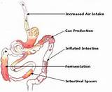 Images of Abdominal Gas Pain Treatment