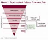 Epilepsy Treatment Protocol Photos