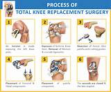Images of Exercises Not To Do After Knee Replacement