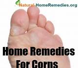 Corn Home Remedies