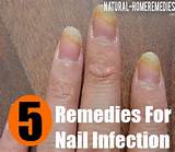 Are There Home Remedies For Yeast Infections