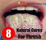Thrush Mouth Treatment Adults