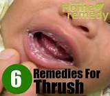 Pictures of Male Thrush Home Remedies