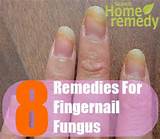 Vinegar Home Remedies For Toe Fungus Images