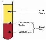 Photos of Blood Plasma Payment