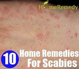 Photos of Skin Rash Treatment Home Remedies