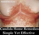 Candida Overgrowth Home Remedies