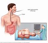 Images of How Do Doctors Check For Hernia