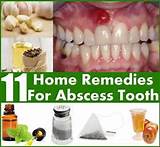Tooth Infection Antibiotics Home Remedies Photos