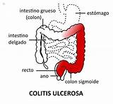 Pictures of Top Ulcerative Colitis Doctors