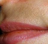 Pictures of Lip Darkening Home Remedies