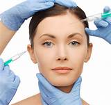 Images of Filler Treatment For Acne Scars