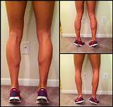 Pictures of Calf Muscle Exercises At Home