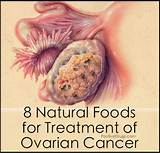 Pictures of Ovarian Cancer Pill Treatment