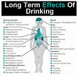 Images of Medical Effects Of Alcohol