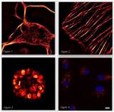 Fluorescence Microscopy Resolution Pictures