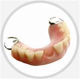 Is A Broken Tooth A Dental Emergency