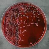 Culture Plates Microbiology Photos