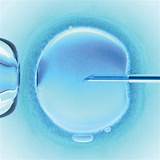 Fertility Treatments Nyc Pictures