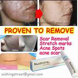 Images of Dark Spot Removal Cream For Face In India