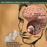 What Does Marijuana Do To Your Body And Brain