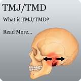 What Is A Tmj Doctor Called Photos