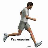 Images of Pes Anserine Bursitis Treatment Exercises