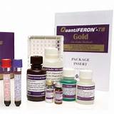 Quantiferon Tb Gold Blood Test Positive Images