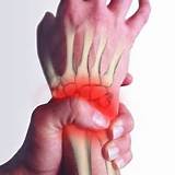 Pictures of Wrist Arthritis Home Remedies