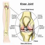 Pictures of Home Remedies For Knee Injuries
