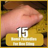 How To Cure A Bee Sting Home Remedies Pictures