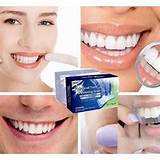 Teeth Bleaching Home Remedies Pictures