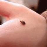 Pictures of Flea Treatment For Bed Bugs