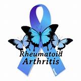 What Doctor Treats Rheumatoid Arthritis Pictures